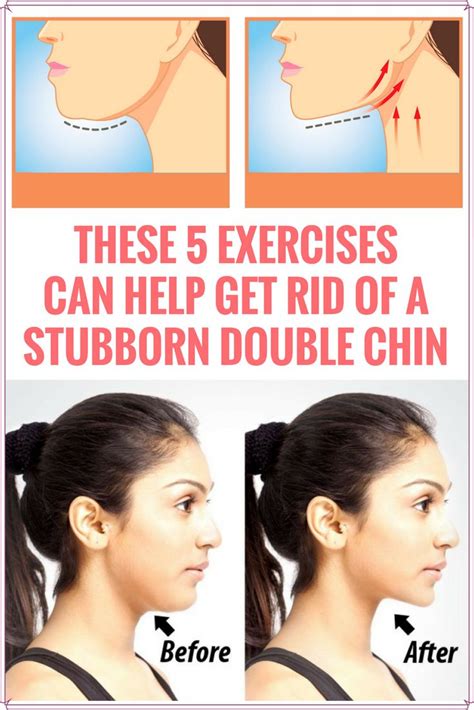 exercise for double chin